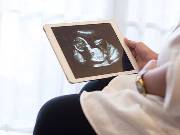 Mujer embarazada observando una ecografía